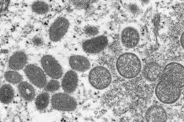 Electron microscopic (EM) image depicts a monkeypox virion, obtained from a clinical sample associated with the 2003 prairie dog outbreak.
